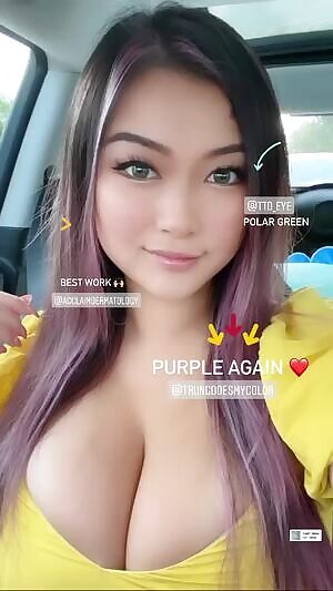Ig story